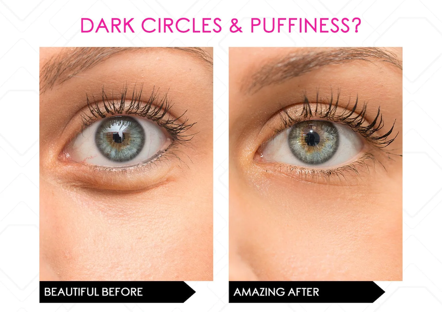 i-Spresso Vibraserum (Eye Serum) Dark Circles & Puffiness- Vibrating Cooling Applicator