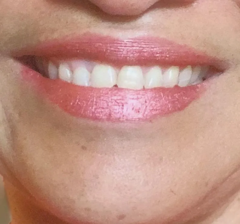 Metallic Coral Shimmer Lipgloss Kit