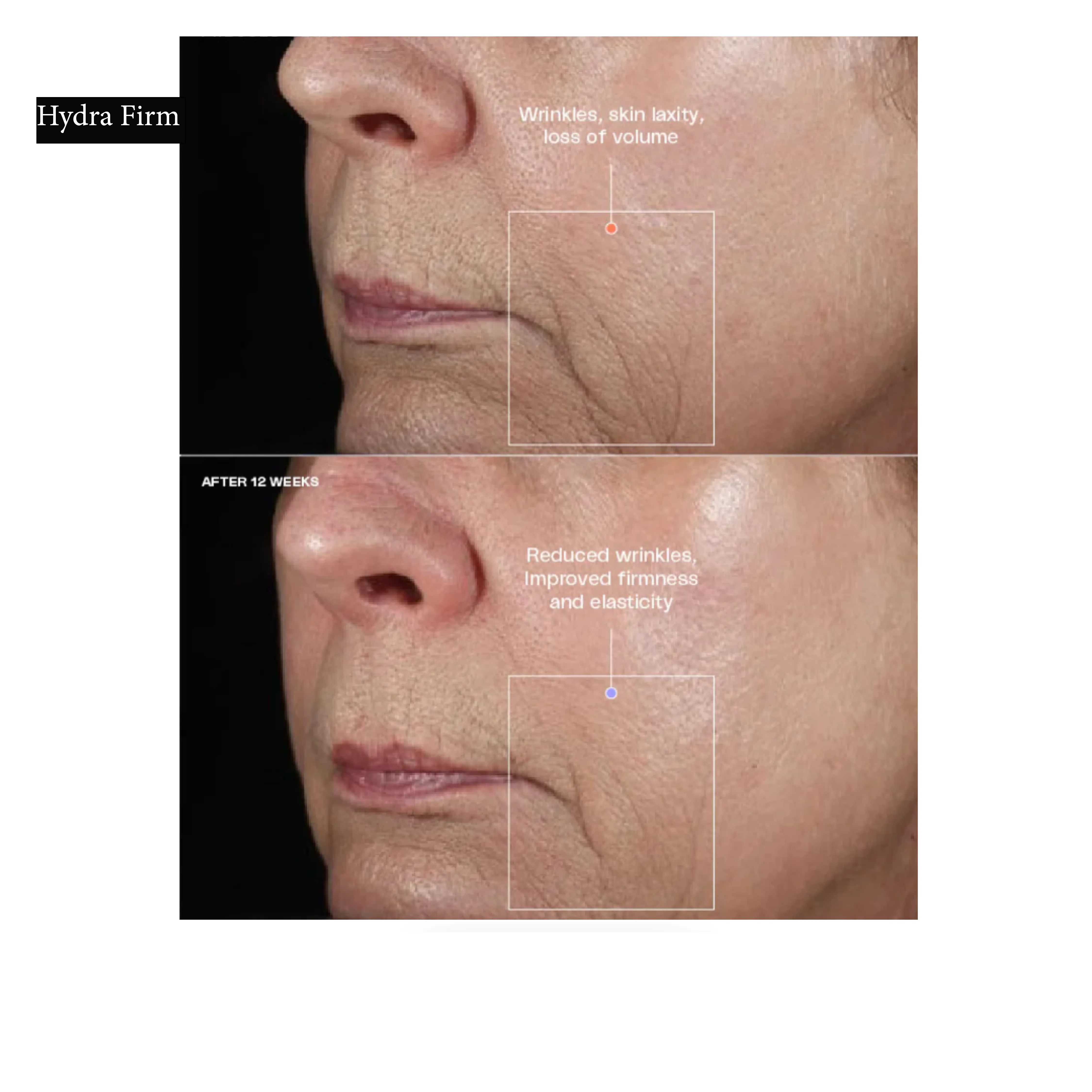 Sente Tighten and Brighten Duo*
