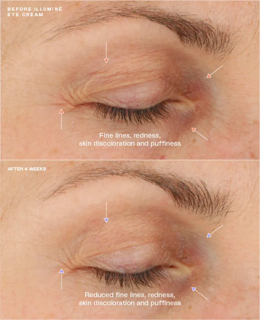 Sente Tighten and Brighten Duo*