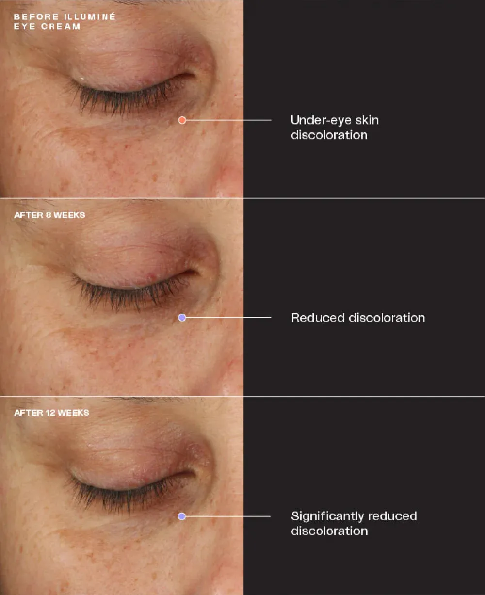 Sente Tighten and Brighten Duo*